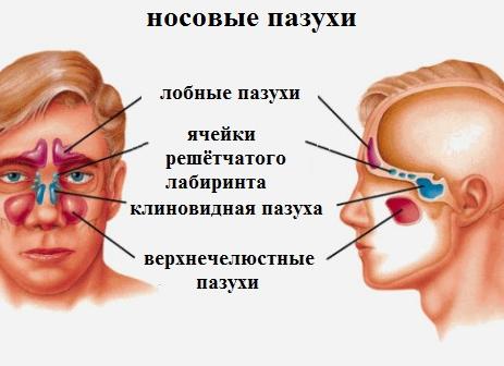 Киста верхнечелюстной пазухи