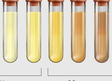 Какого цвета моча у здорового человека