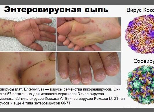 Инфекция что это