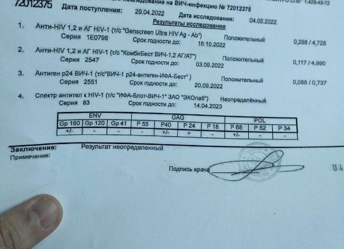 Иммуноблот на вич неопределенный