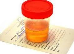 Гной в моче у женщин причины