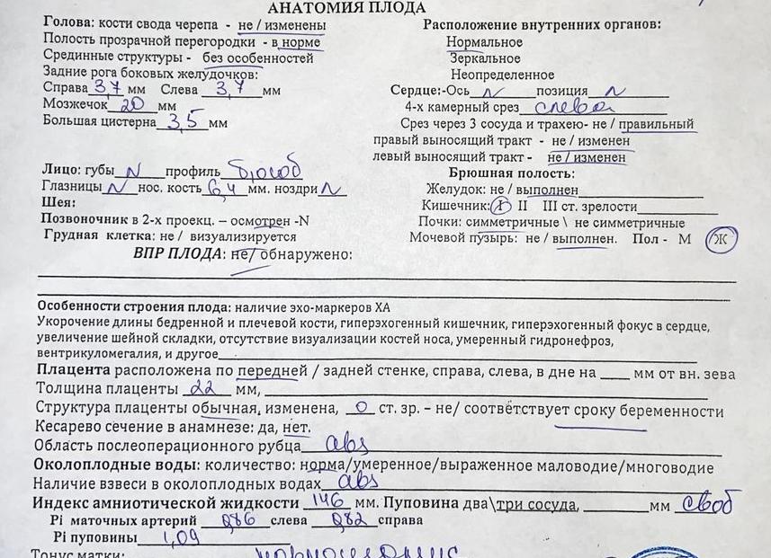 Боковые желудочки мозга норма у плода 20 недель