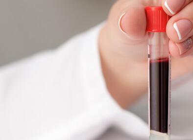 Анализ на женские гормоны при климаксе