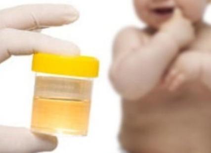 Анализ мочи по сулковичу где сдать