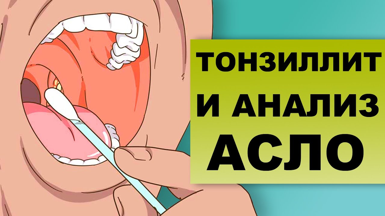 Анализ асло что это такое