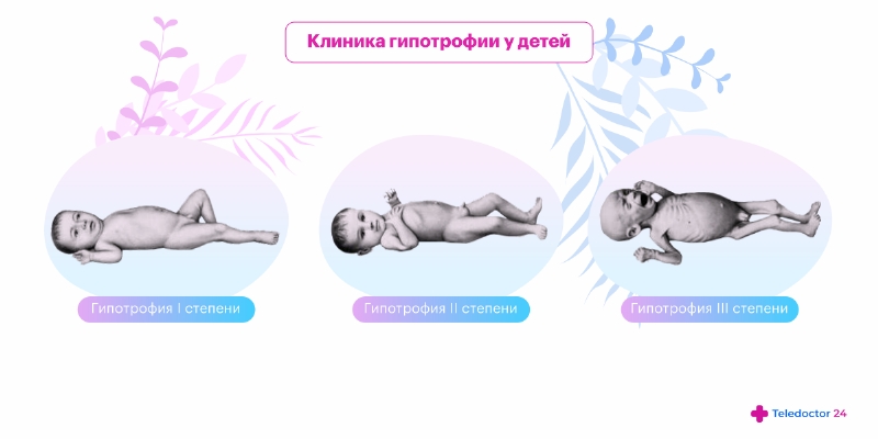 Гипотрофия плода 1 степени
