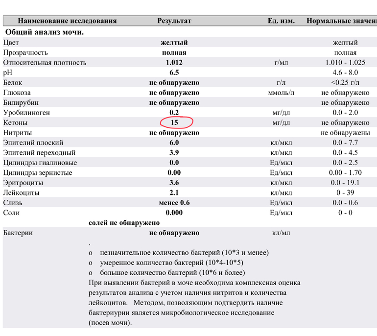 Кетоны в моче норма