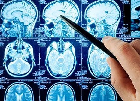 Мрт что это такое головного мозга Мрт что это такое головного мозга