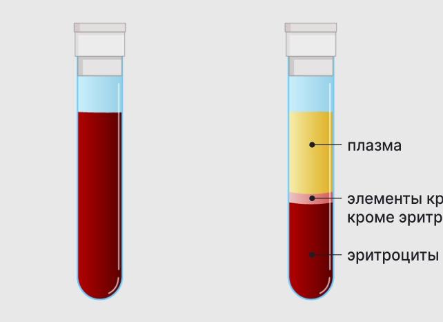 Много сои в крови