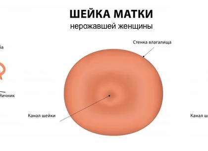 Какая должна быть шейка матки Какая должна быть шейка матки