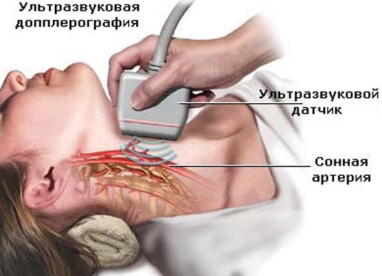 Дс бца что это такое