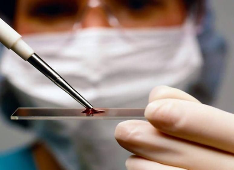 Анализ на биопсию