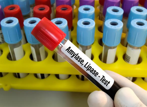 Амилаза панкреатическая что это