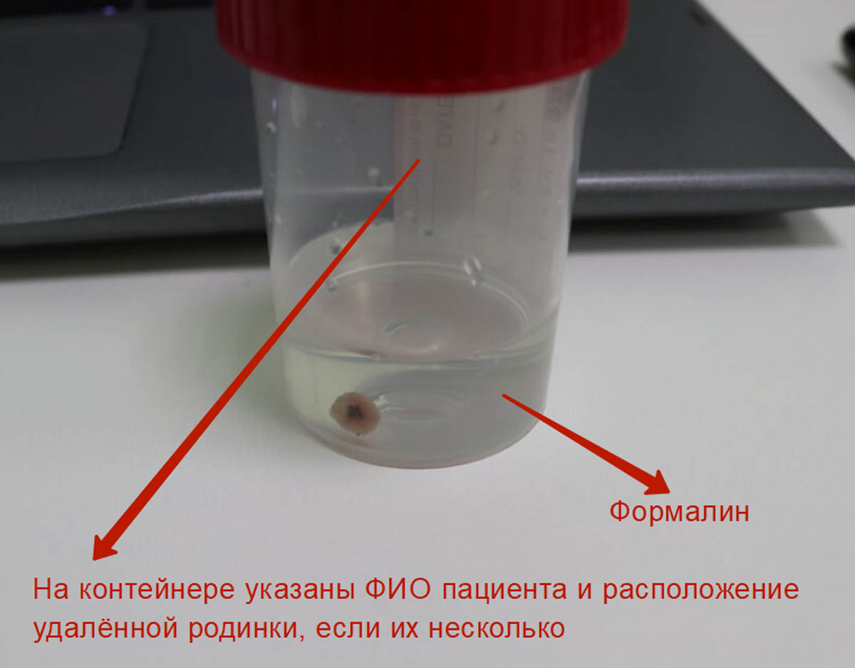 Гистология сколько дней делается анализ