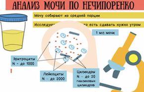 Как у грудничка собрать мочу по нечипоренко