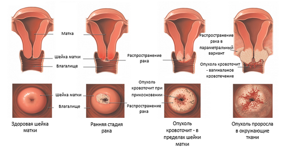 Какая должна быть шейка матки
