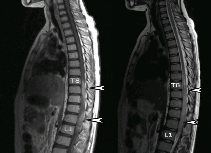 Мрт спины что такое