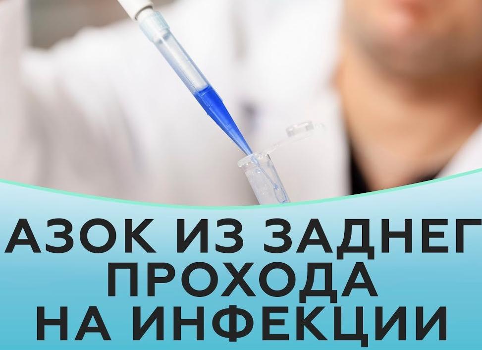 Мазок из заднего прохода