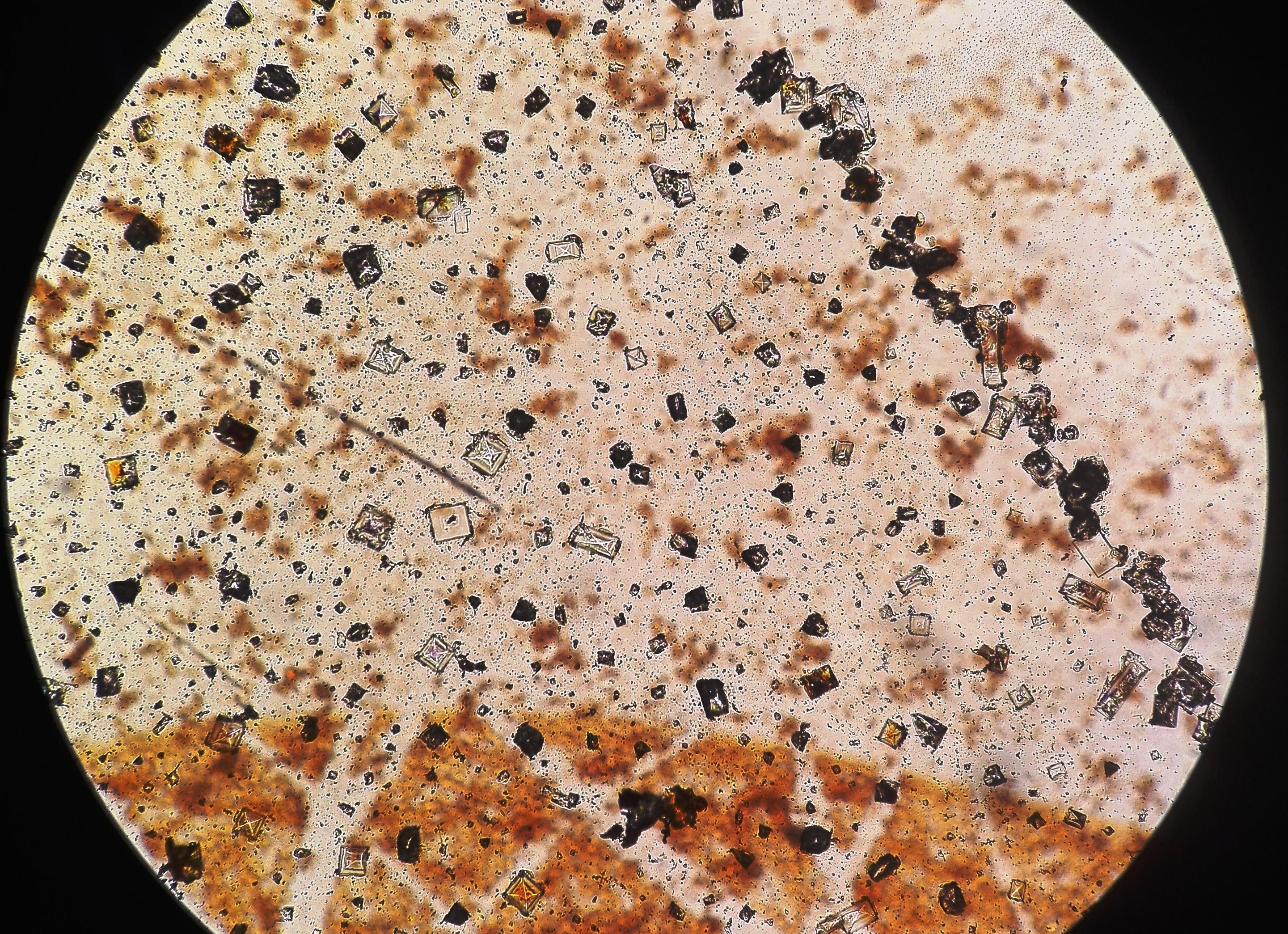 Кристаллы оксалата кальция