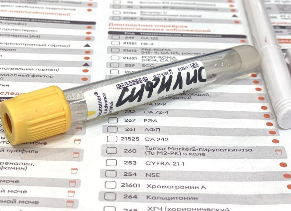 Исследование крови на сифилис