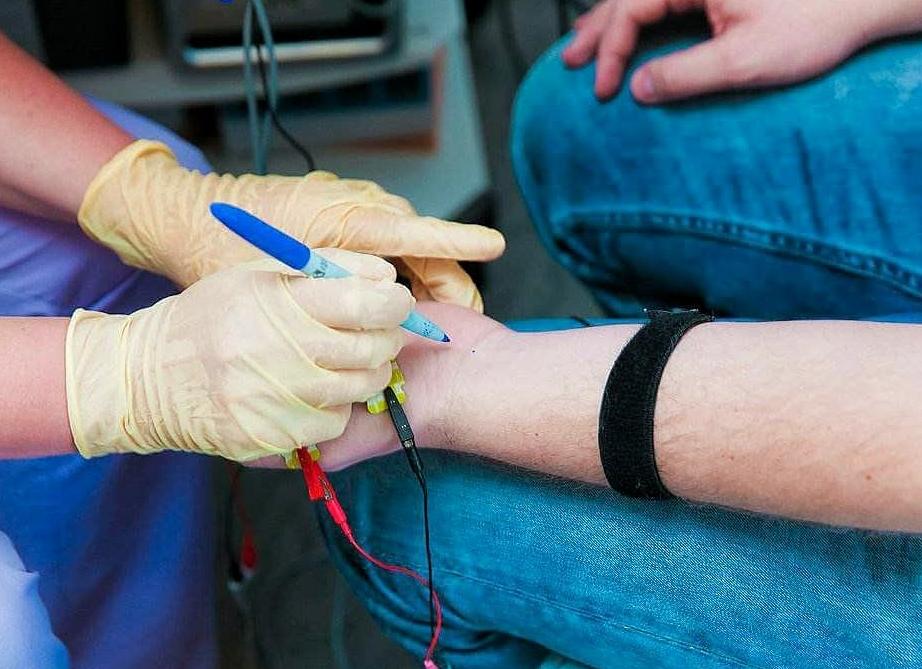 Электронейромиография верхних конечностей