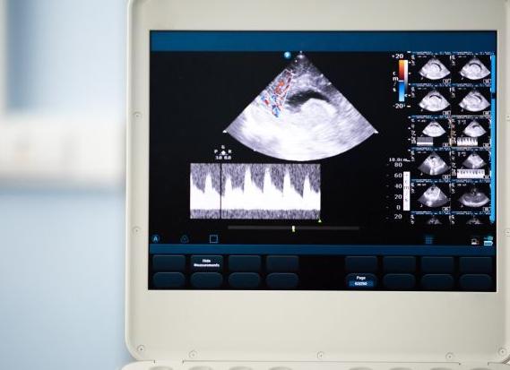 Эхоэнцефалограмма головного мозга сделать