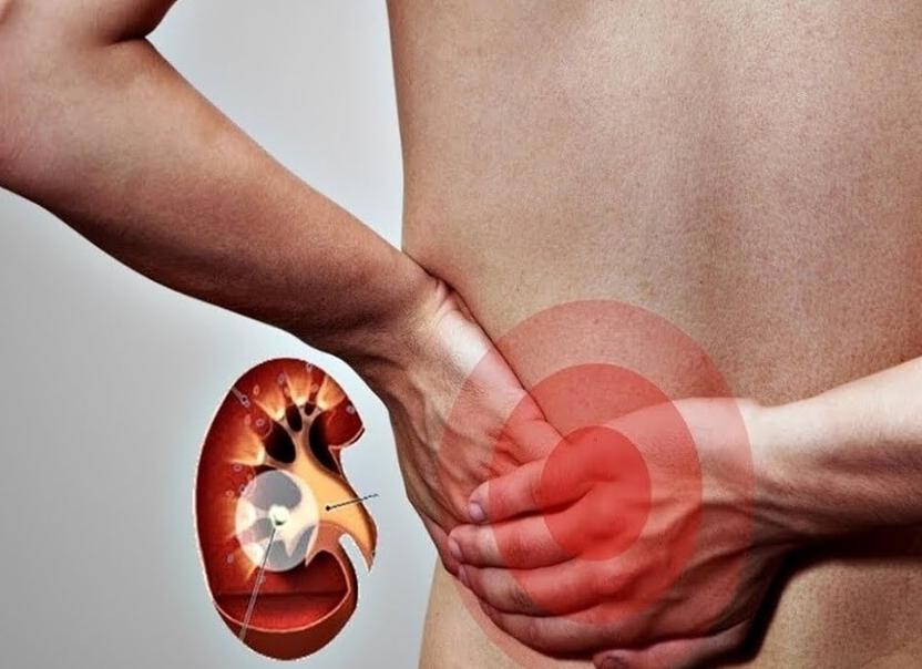 Диагностика заболеваний почек