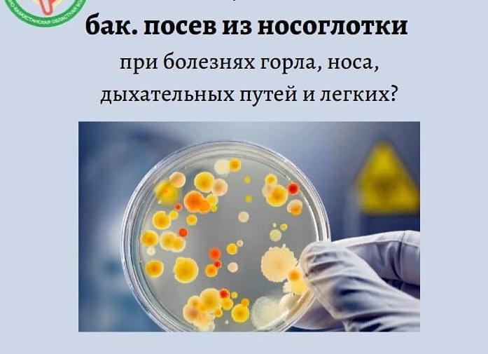 Бак посев из горла