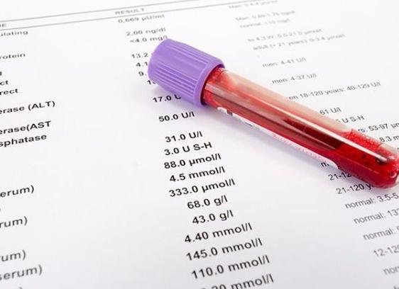 Анализ мочи на креатинин