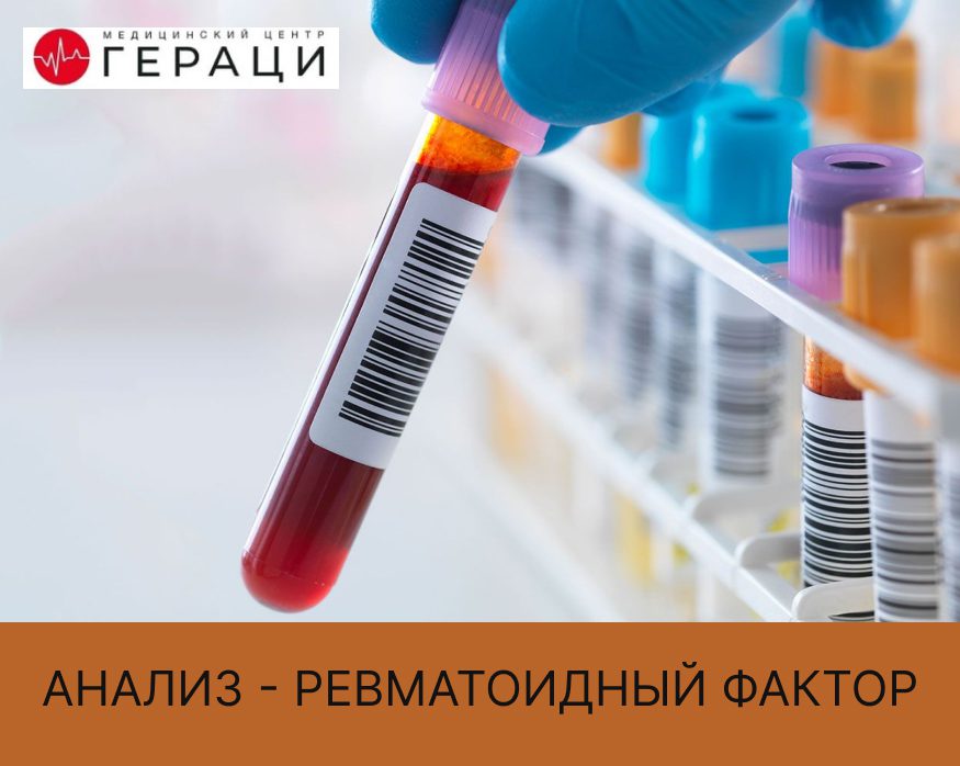 Анализ крови на ревматоидный фактор что это такое
