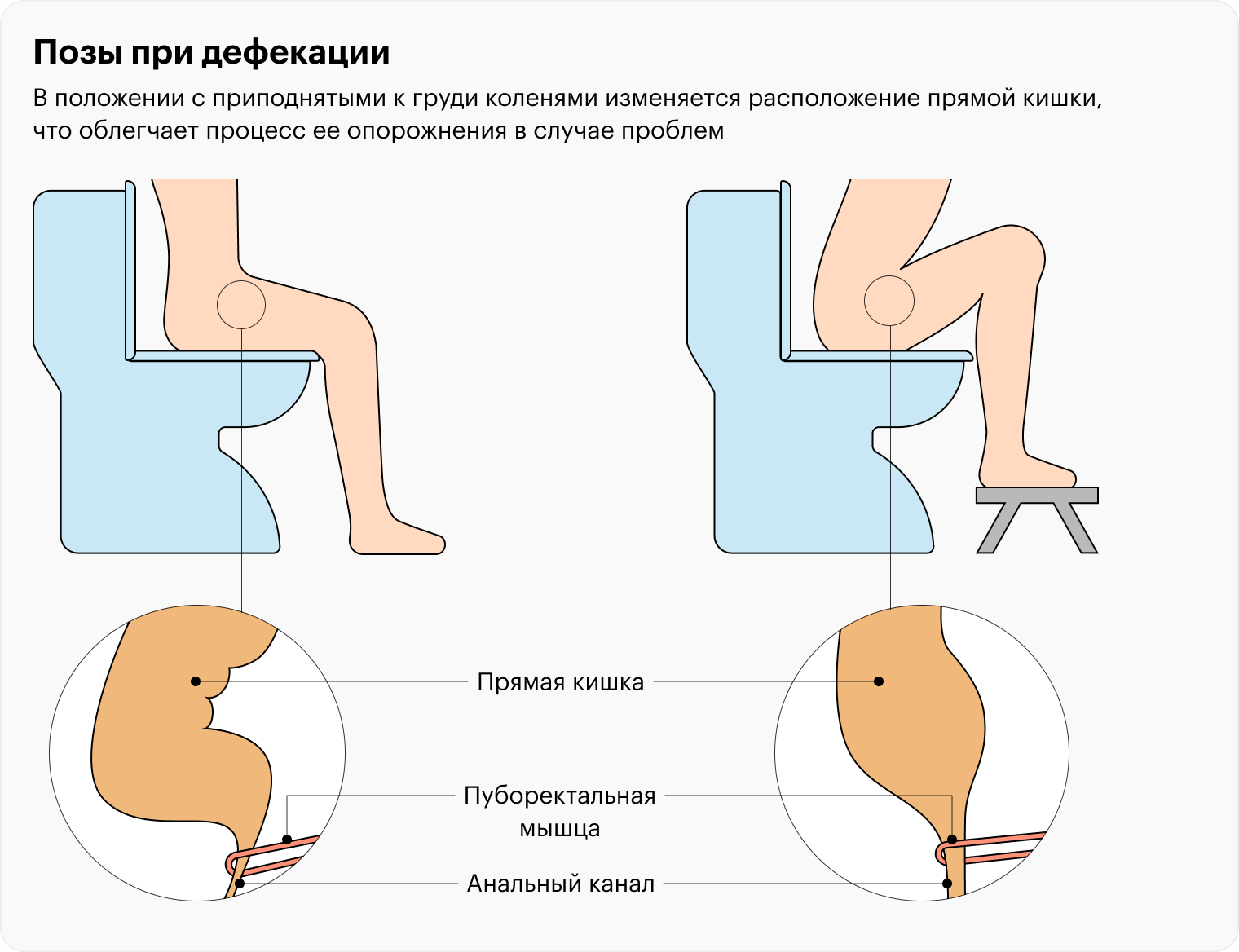 Как сдать кал если не хочешь в туалет