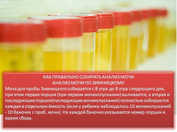 Как собрать суточную мочу на белок