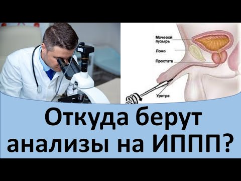 Мазок у мужчин на иппп