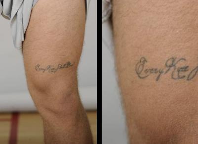 Мрт и татуировки