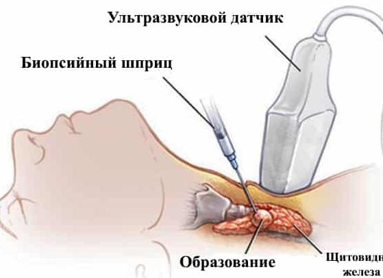 Кровь на биопсию это что