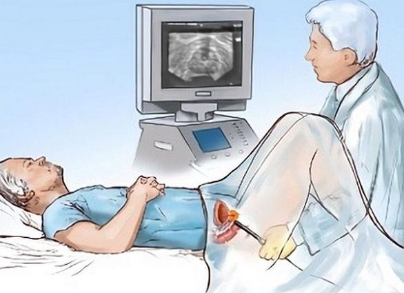 Как подготовиться к узи предстательной железы и мочевого пузыря