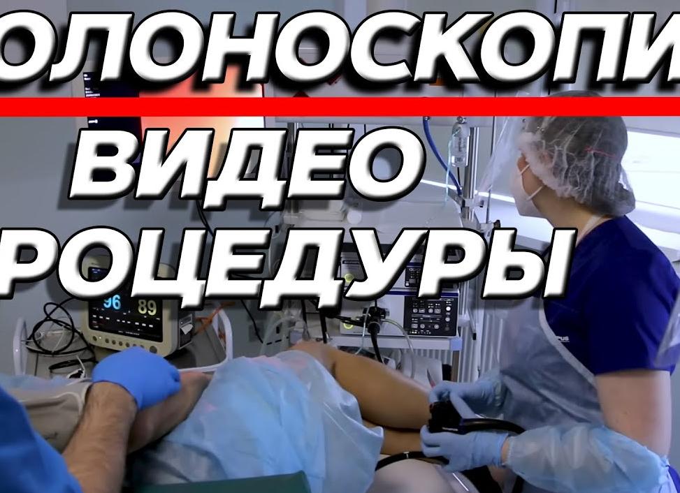 Как безболезненно пройти колоноскопию