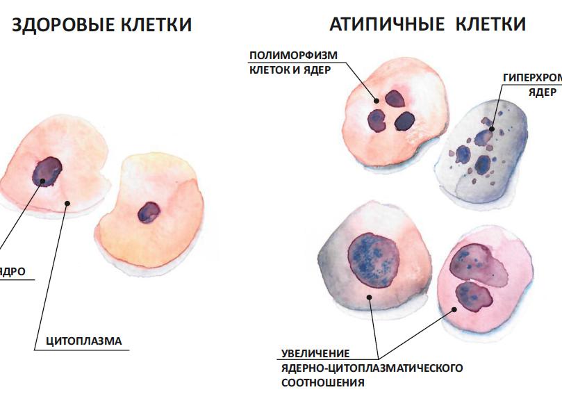 Гистология что это такое в гинекологии матки