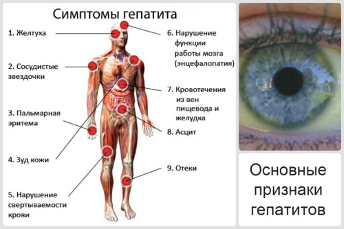 Гепатит с последствия