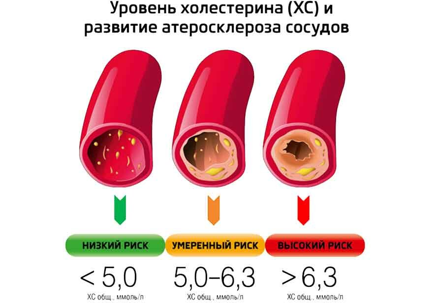 Лпнп что это такое норма