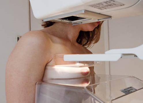Можно ли делать маммографию