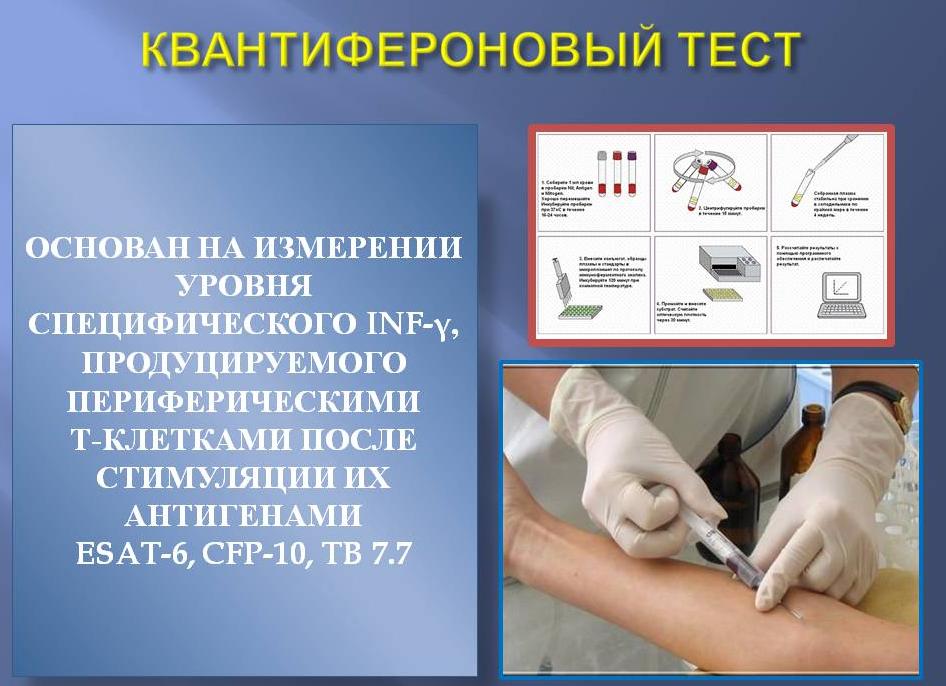 Квантифероновый тест это Квантифероновый тест это