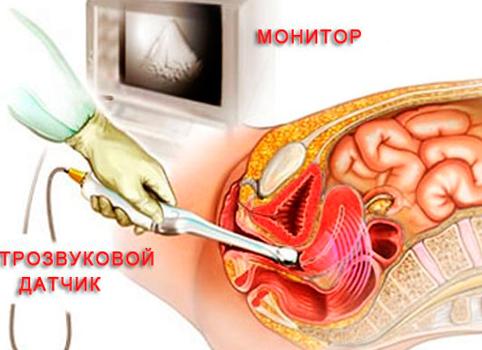 Фолликулогенез как делается