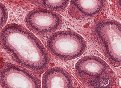 Что такое гистология в онкологии