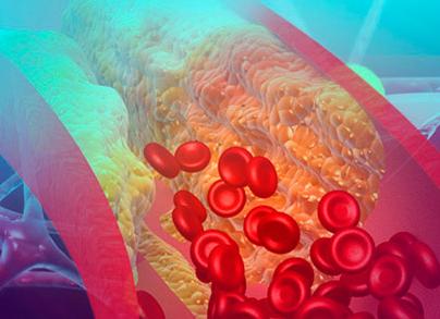 Анализ крови повышены триглицериды