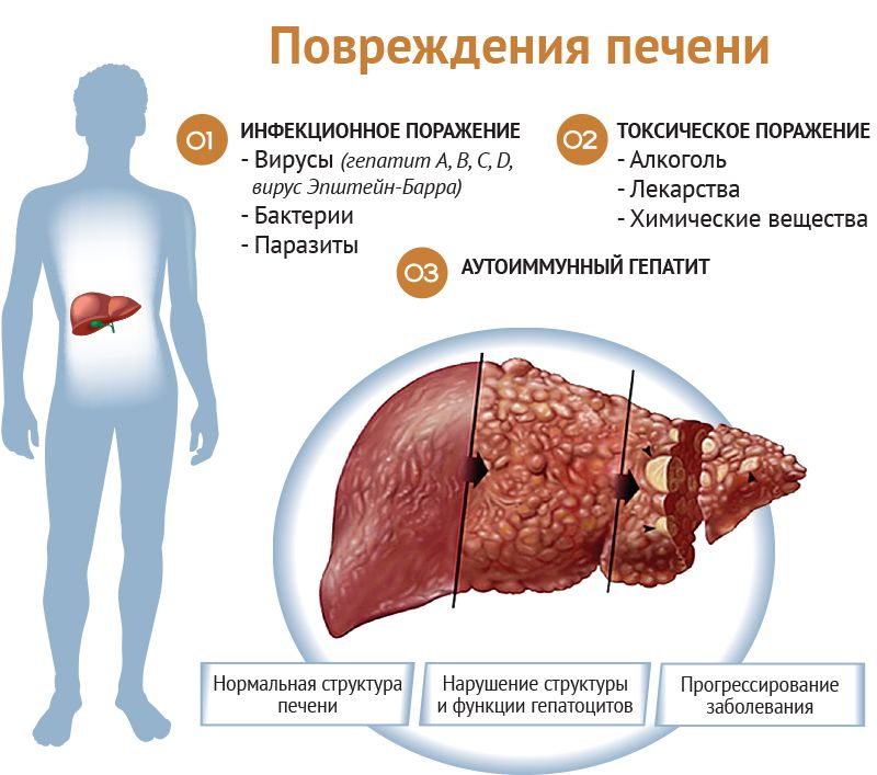 Как можно проверить печень здорова ли она