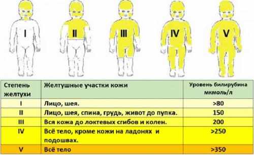 Как снизить билирубин в домашних условиях