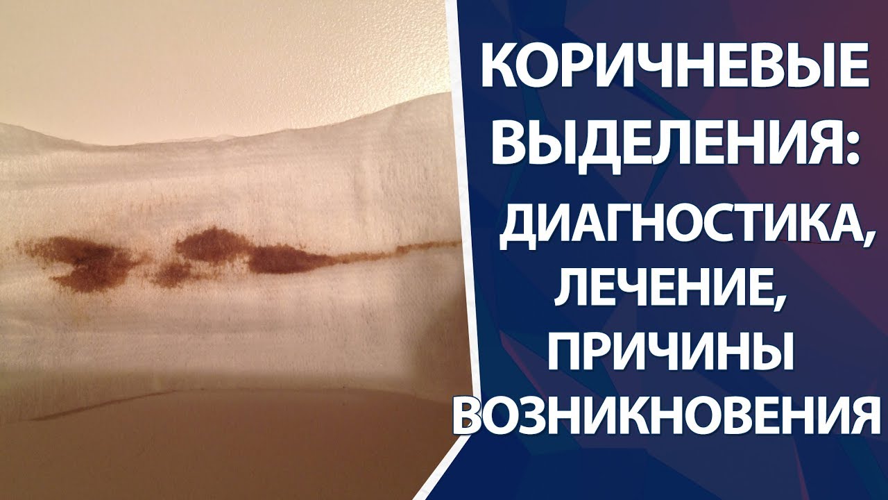 Какие выделения после месячных