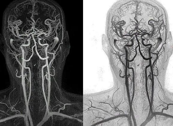 Кт что это головы