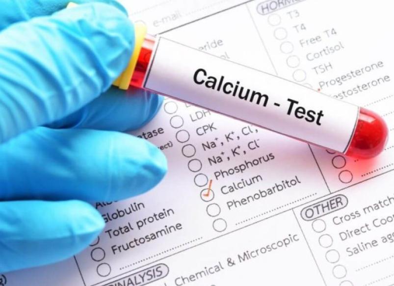 Кровь на кальций как сдавать